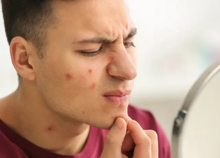 Person popping a pimple